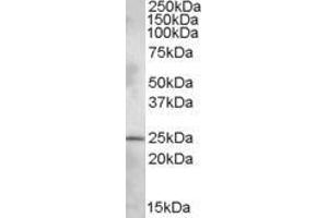 ABIN308463 (1µg/ml) staining of Rat Brain lysate (35µg protein in RIPA buffer).