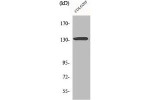 Western Blot analysis of COLO205 cells using CARD 11 Polyclonal Antibody (CARD11 Antikörper  (N-Term))