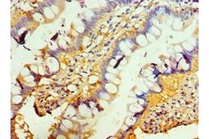 Immunohistochemistry of paraffin-embedded human small intestine tissue using ABIN7173851 at dilution of 1:100 (TACI Antikörper  (AA 184-293))