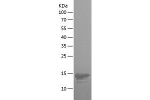 Western Blotting (WB) image for Integrin beta 7 (ITGB7) (AA 71-172) protein (His tag) (ABIN7123474)