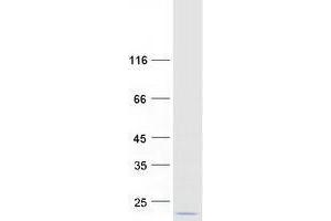 Validation with Western Blot