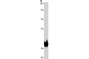 Western Blotting (WB) image for anti-Aspartoacylase (ASPA) antibody (ABIN2429545) (ASPA Antikörper)