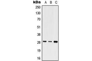 Western blot analysis of SHOX expression in HEK293T (A), Raw264. (SHOX Antikörper  (Center))