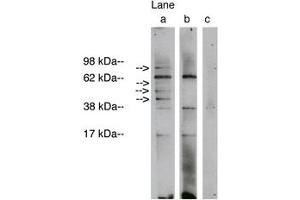 Image no. 1 for anti-Ceramide Synthase 1 (CERS1) antibody (ABIN793691) (LASS1 Antikörper)