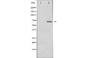 Western blot analysis of PKCB expression in HeLa whole cell lysates,The lane on the left is treated with the antigen-specific peptide. (PKC beta Antikörper  (C-Term))