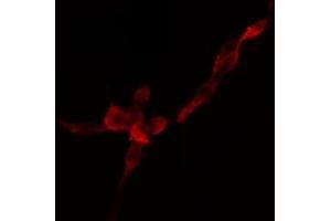 ABIN6274757 staining HuvEc cells by IF/ICC. (RPS4Y1 Antikörper)