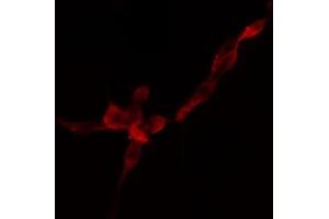 ABIN6274757 staining HuvEc cells by IF/ICC.
