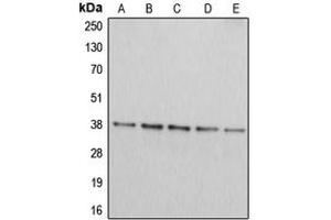 Western blot analysis of Arginase 2 expression in Jurkat (A), HepG2 (B), HEK293T (C), A549 (D), PC12 (E) whole cell lysates. (ARG2 Antikörper  (C-Term))