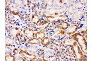 IHC testing of FFPE mouse kidney with SLC22A2 antibody.