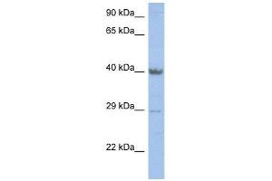 ZNF474 antibody used at 2. (ZNF474 Antikörper  (Middle Region))