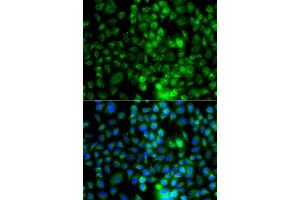 Immunofluorescence analysis of A549 cell using EPHA1 antibody. (EPHA1 Antikörper)