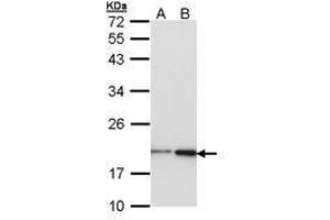 Image no. 1 for anti-Non-Metastatic Cells 1, Protein (NM23A) Expressed in (NME1) (AA 1-120) antibody (ABIN467572) (NME1 Antikörper  (AA 1-120))