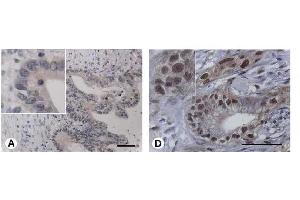 Image no. 1 for anti-Integrin-Binding Sialoprotein (IBSP) antibody (ABIN191813) (IBSP Antikörper)