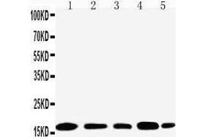 Anti-TIA1 antibody, Western blotting Lane 1: JURKAT Cell Lysate Lane 2: RAJI Cell Lysate Lane 3: CEM Cell Lysate Lane 4:  Cell Lysate Lane 5: K562 Cell Lysate