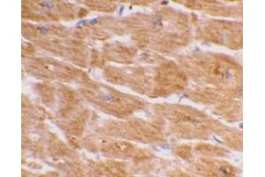 Immunohistochemical staining of human heart tissue using AP30187PU-N Caspase-1 antibody at 2 μg/ml. (Caspase 1 Antikörper  (C-Term))