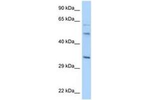 Image no. 1 for anti-Williams Beuren Syndrome Chromosome Region 22 (WBSCR22) (AA 200-249) antibody (ABIN6748061) (WBSCR22 Antikörper  (AA 200-249))