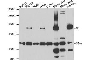 Western blot analysis of extracts of various cell lines, using C3 antibody (ABIN5975433) at 1/1000 dilution. (C3 Antikörper)