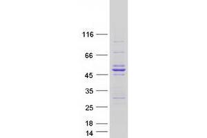 Western Blotting (WB) image for Actin, alpha 2, Smooth Muscle, Aorta (ACTA2) (Transcript Variant 1) protein (Myc-DYKDDDDK Tag) (ABIN2714356)