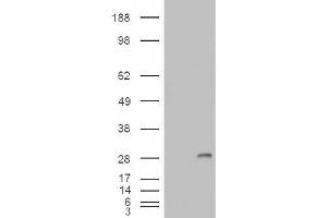 Image no. 2 for anti-Insulin-Like Growth Factor Binding Protein 6 (IGFBP6) (Internal Region) antibody (ABIN374965) (IGFBP6 Antikörper  (Internal Region))