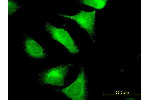 Immunofluorescence of monoclonal antibody to CNTN4 on HeLa cell.
