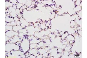 Formalin-fixed and paraffin embedded rat lung labeled with Anti PABP Polyclonal Antibody, Unconjugated (ABIN704786) at 1:200 followed by conjugation to the secondary antibody and DAB staining (PABP Antikörper  (AA 101-200))