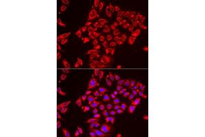 Immunofluorescence analysis of HeLa cells using ST3GAL3 antibody. (ST3GAL3 Antikörper  (AA 30-375))
