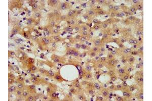IHC image of ABIN7145458 diluted at 1:800 and staining in paraffin-embedded human liver tissue performed on a Leica BondTM system. (CHN2 Antikörper  (AA 1-91))