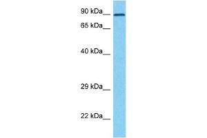 Host:  Rabbit  Target Name:  ZP2  Sample Type:  HT1080 Whole Cell lysates  Antibody Dilution:  1. (ZP2 Antikörper  (C-Term))