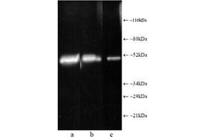 Western blot analysis: Composite luminograph of (a) HeLa S3 cytosolic preparation, (b) purified 26S proteasome, and (c) human placental proteasome fraction after SDS PAGE followed by blotting onto PVDF membrane and probing with antibody . (Proteasome 19S Rpt1/S7 Subunit Antikörper)