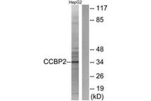 Western blot analysis of extracts from HepG2 cells, using CCBP2 Antibody. (CCBP2 Antikörper  (AA 335-384))