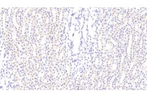 Detection of CCND1 in Rat Kidney Tissue using Polyclonal Antibody to Cyclin D1 (CCND1)
