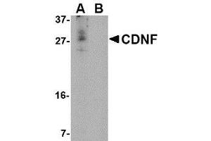 Western blot analysis of CDNF in A-20 cell lysate in (A) the absence and (B) the presence of blocking peptide with AP30222PU-N CDNF antibody at 1 μg/ml. (CDNF Antikörper  (N-Term))