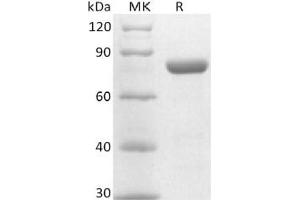 Western Blotting (WB) image for Poliovirus Receptor-Related 4 (PVRL4) (Active) protein (Fc Tag) (ABIN7320868) (PVRL4 Protein (Fc Tag))