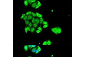 Immunofluorescence analysis of A549 cells using Rad51D Polyclonal Antibody (RAD51D Antikörper)