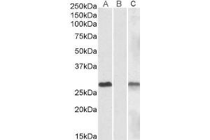 Lane A - ABIN570830 (1µg/ml) staining of HEK293 overexpressing Human DYDC1 lysate (10µg protein in RIPA buffer) Lane B - ABIN570830 (1µg/ml) staining of HEK293 mock-transfected lysate (10µg protein in RIPA buffer). (DYDC1 Antikörper  (Internal Region))