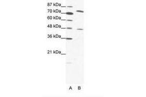 Image no. 1 for anti-Zinc Finger Protein 225 (ZNF225) (AA 127-176) antibody (ABIN202877) (ZNF225 Antikörper  (AA 127-176))