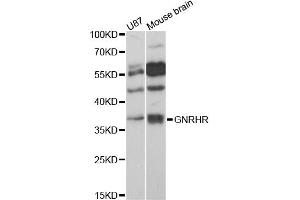 Western blot analysis of extracts of various cell lines, using GNRHR antibody (ABIN6292108) at 1:3000 dilution. (GNRHR Antikörper)