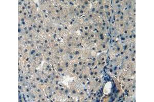 Used in DAB staining on fromalin fixed paraffin- embedded liver tissue