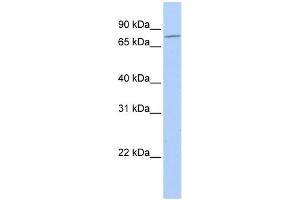 WB Suggested Anti-MZF1 Antibody Titration: 0. (MZF1 Antikörper  (N-Term))