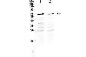 Western blot analysis of MAK using anti-MAK antibody . (MAK Antikörper  (C-Term))