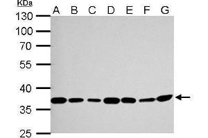 Western Blotting (WB) image for anti-Thymidylate Synthetase (TYMS) antibody (ABIN2855587)