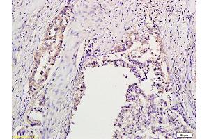 anti-Aurora A+B+C (AA 51-150) antibody