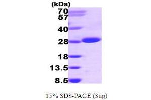 SDS-PAGE (SDS) image for Inosine Triphosphatase (ITPA) (AA 1-194) protein (His tag) (ABIN667158) (ITPA Protein (AA 1-194) (His tag))
