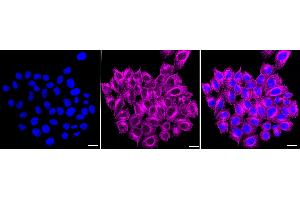 anti-Ectonucleotide Pyrophosphatase/phosphodiesterase 5 (ENPP5) antibody