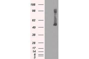 Image no. 2 for anti-Glucokinase (Hexokinase 4) (GCK) antibody (ABIN1498413)
