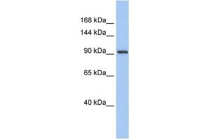 WB Suggested Anti-ZNF295 Antibody Titration:  0.