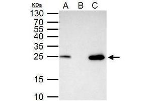 IP Image mtTFA antibody immunoprecipitates mtTFA protein in IP experiments. (TFAM Antikörper)