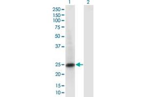 Western Blot analysis of RAB6B expression in transfected 293T cell line by RAB6B monoclonal antibody (M02), clone 1A5. (RAB6B Antikörper  (AA 1-208))