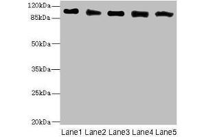 Western blot All lanes: COPB2 antibody at 2. (COPB2 Antikörper  (AA 657-906))