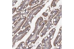Immunohistochemical staining of human small intestine with TMEM187 polyclonal antibody  shows moderate cytoplasmic positivity in glandular cells.